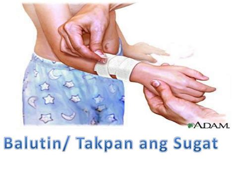 sugat sa tuhod photos|First Aid Tips Para sa Mga Sugat at .